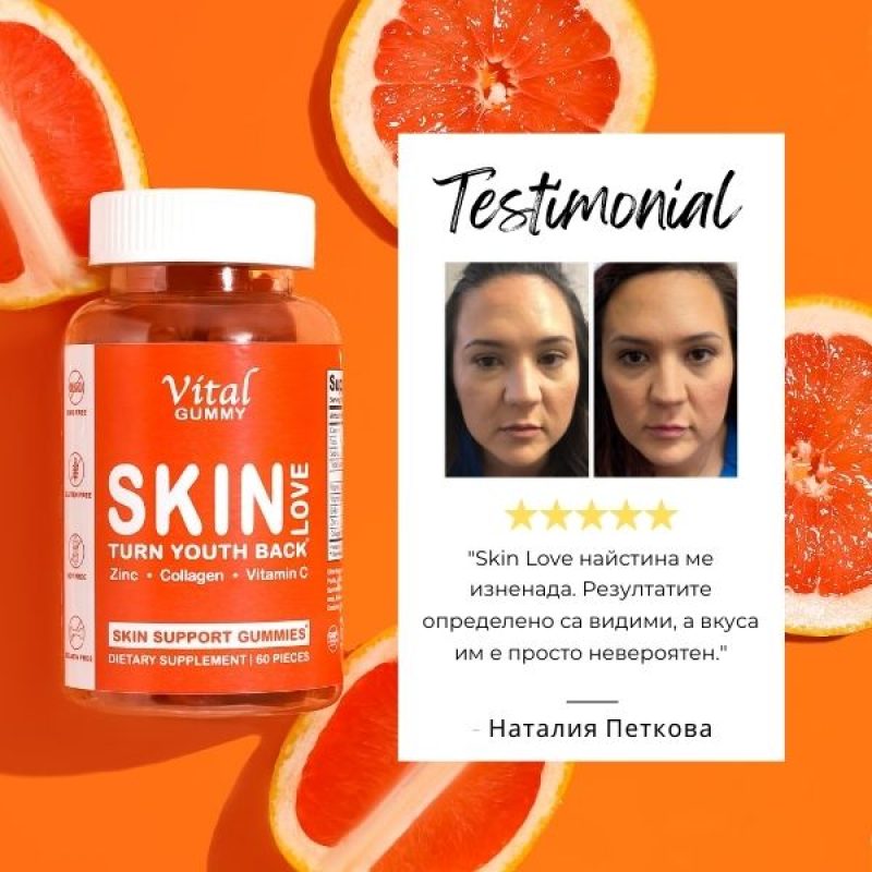 skin love ревю